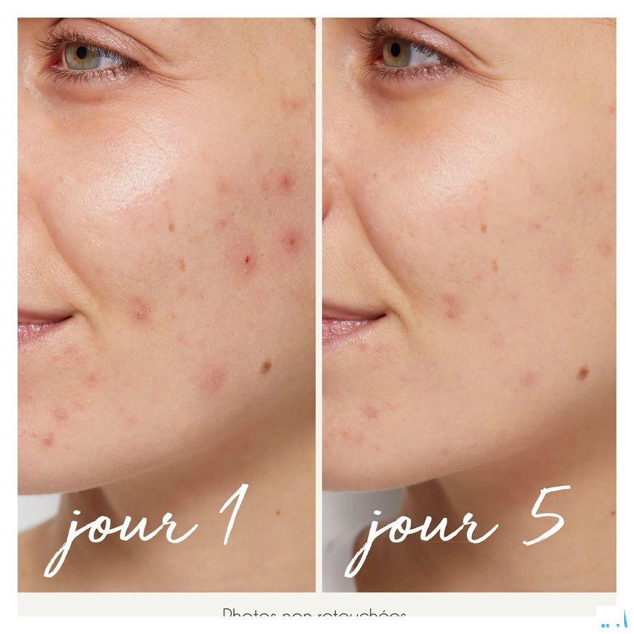La Rosee Serum Purif A/Imperf Zn & Acid.Frui.Bio 30 ml