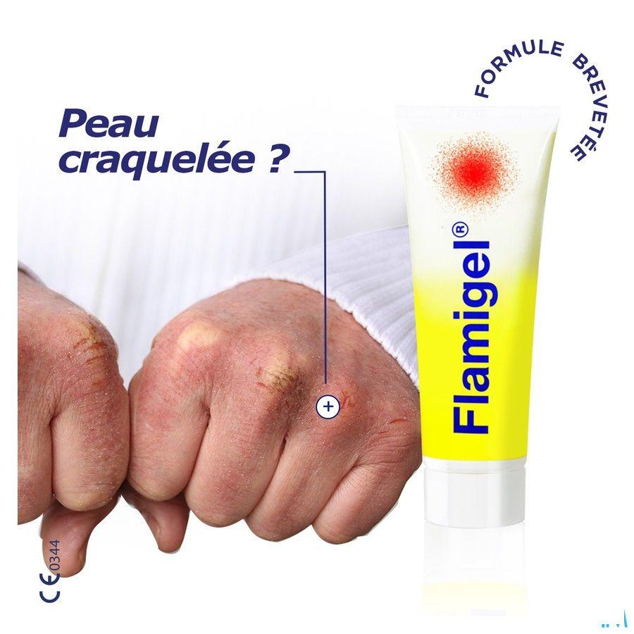 Flamigel Tube 100 gr 