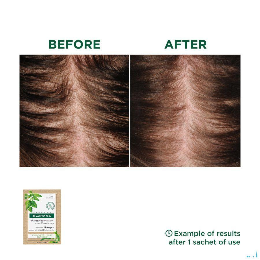 Klorane Capilaire Masker Reinigend Brandnetel 8X3G