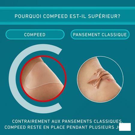 Compeed Blarenpleisters Medium Voordeelverpak. 10