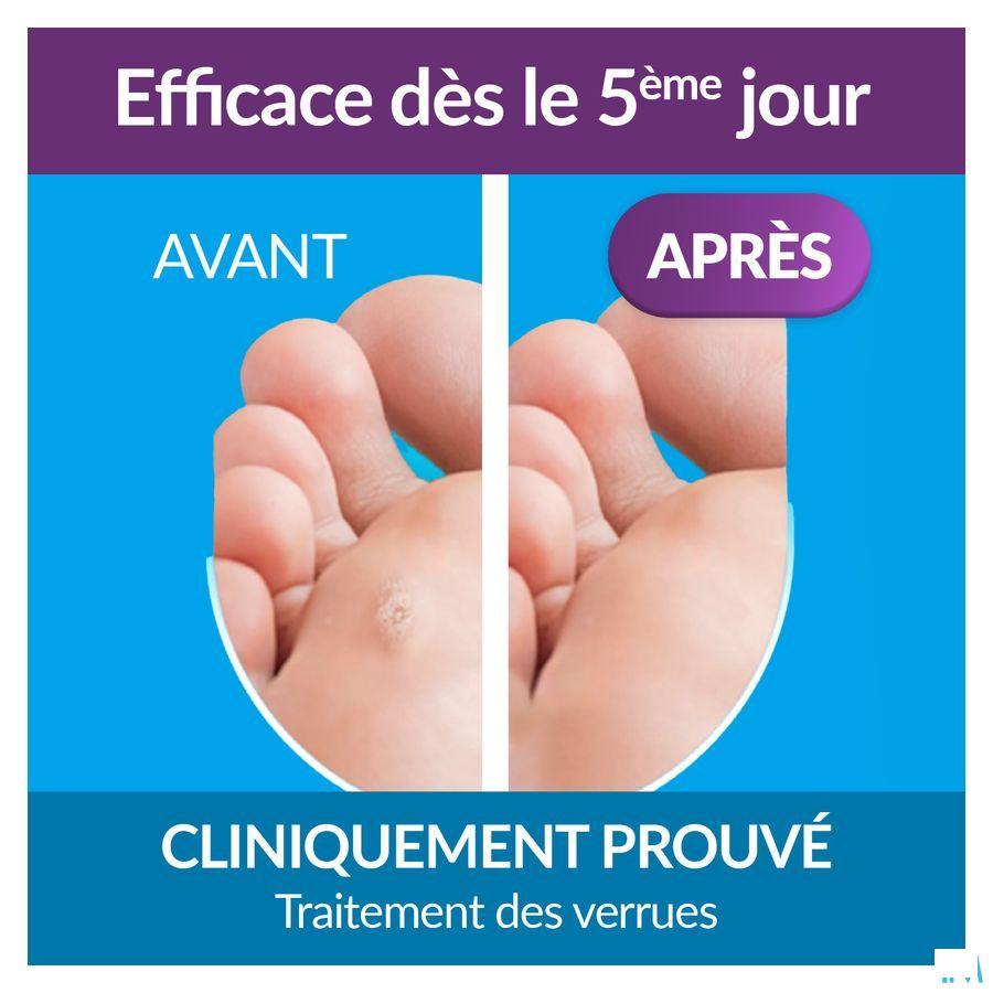Excilor Traitement Verrues Duo Power 10 ml+1,5 gr