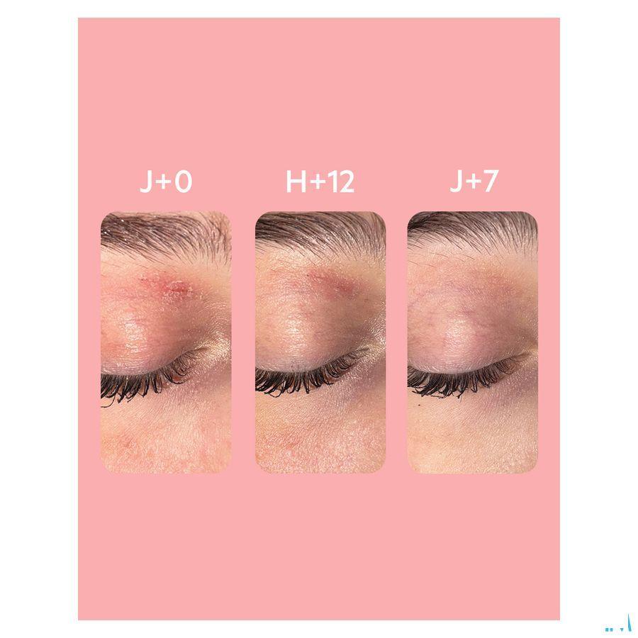 Svr Topialyse Palpebral Baume 30 ml