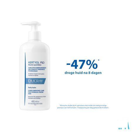 Ducray Kertyol Pso Balsem Dagelijks Gebruik 200ml  -  Ducray 