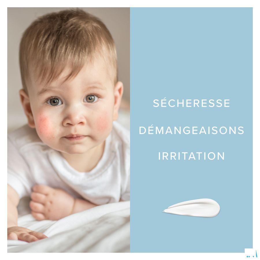 Dermalex Baby Eczema Creme 30 gr