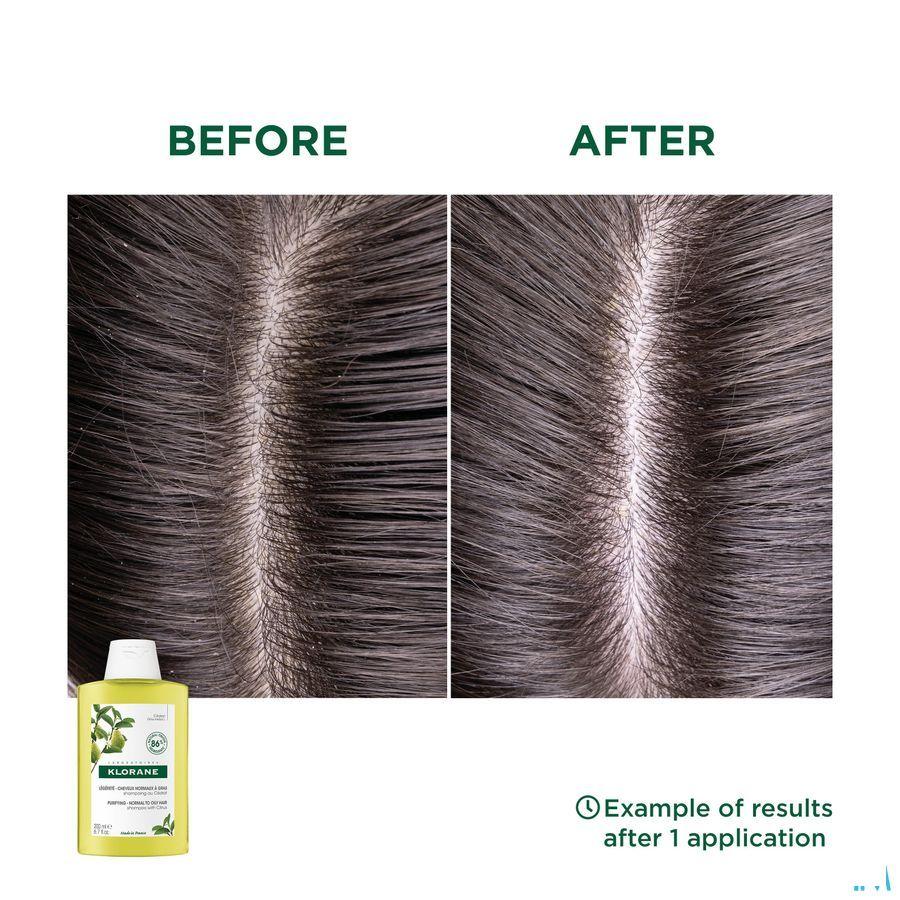 Klorane Capilaire Shampoo Cederappel 200 ml