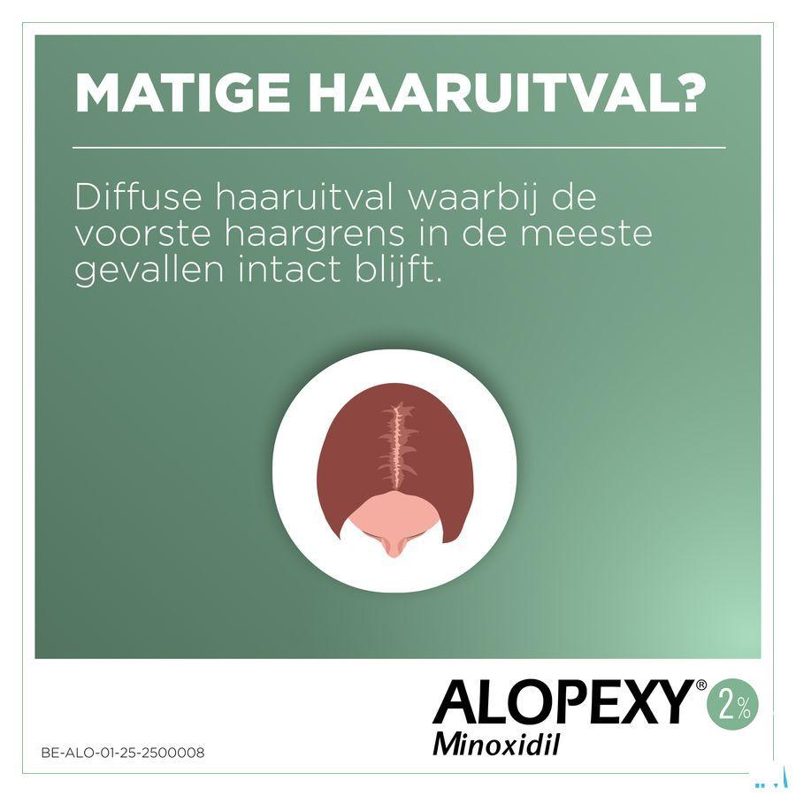 Alopexy 2 % Liquid Flacon Plast et 3x60 ml