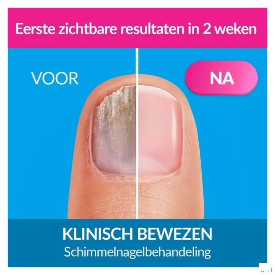 Excilor Liquid 3,3 ml