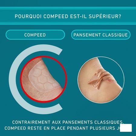 Compeed Blarenpleisters Extreem Voordeelverpak.10