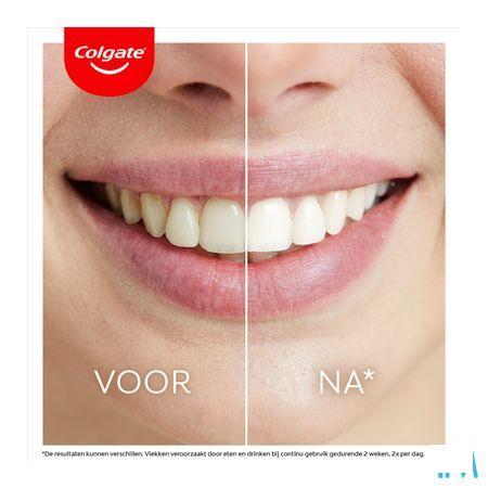 Colgate Max White Led Whitening Kit 2 Prod.