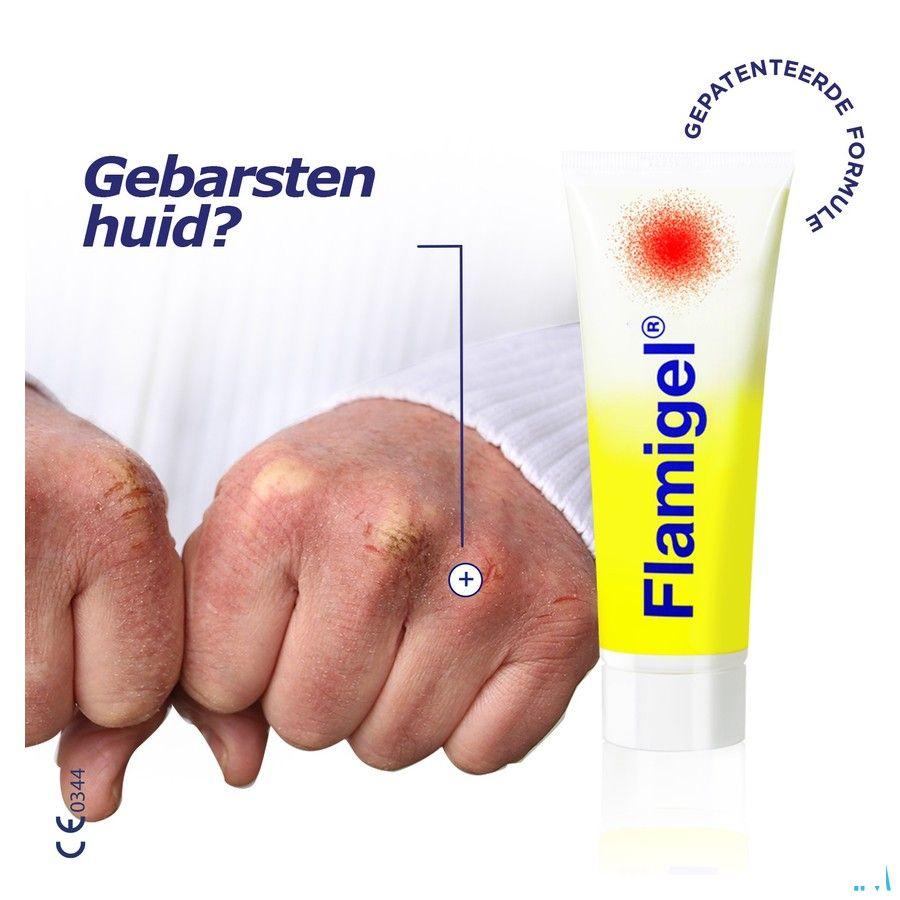 Flamigel Tube 100 gr 