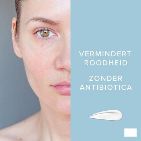 Dermalex Creme Anti rougeurs 30 gr