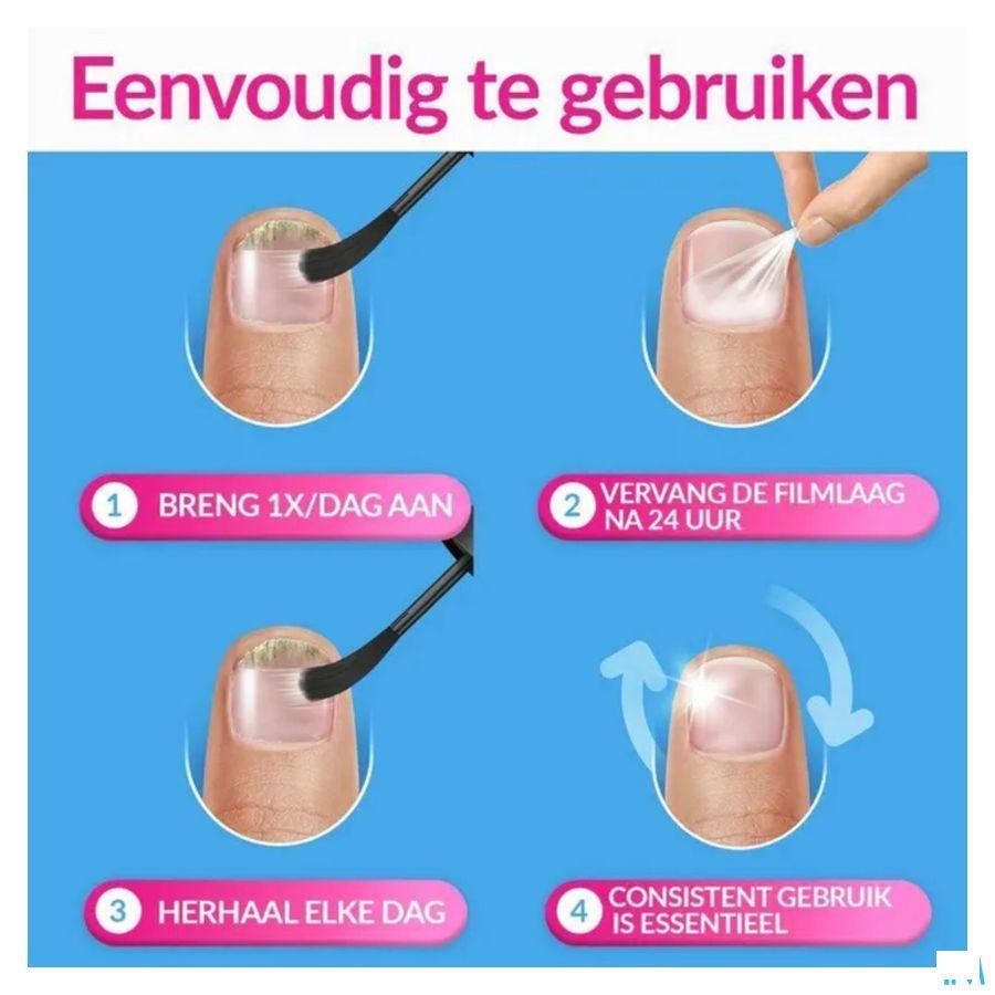 Excilor Forte Schimmelnagels 30 ml