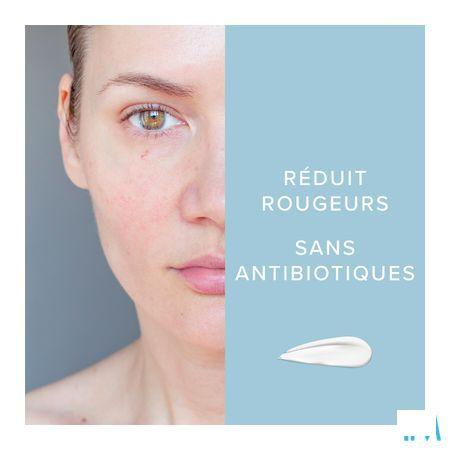 Dermalex Creme Anti rougeurs 30 gr