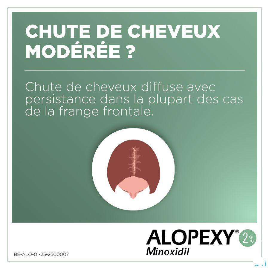 Alopexy 2 % Liquid Flacon Plast et 3x60 ml