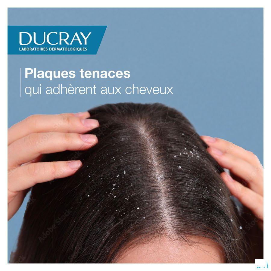Ducray Kelual Squanorm Shampoo Vette Schilfers 400 ml
