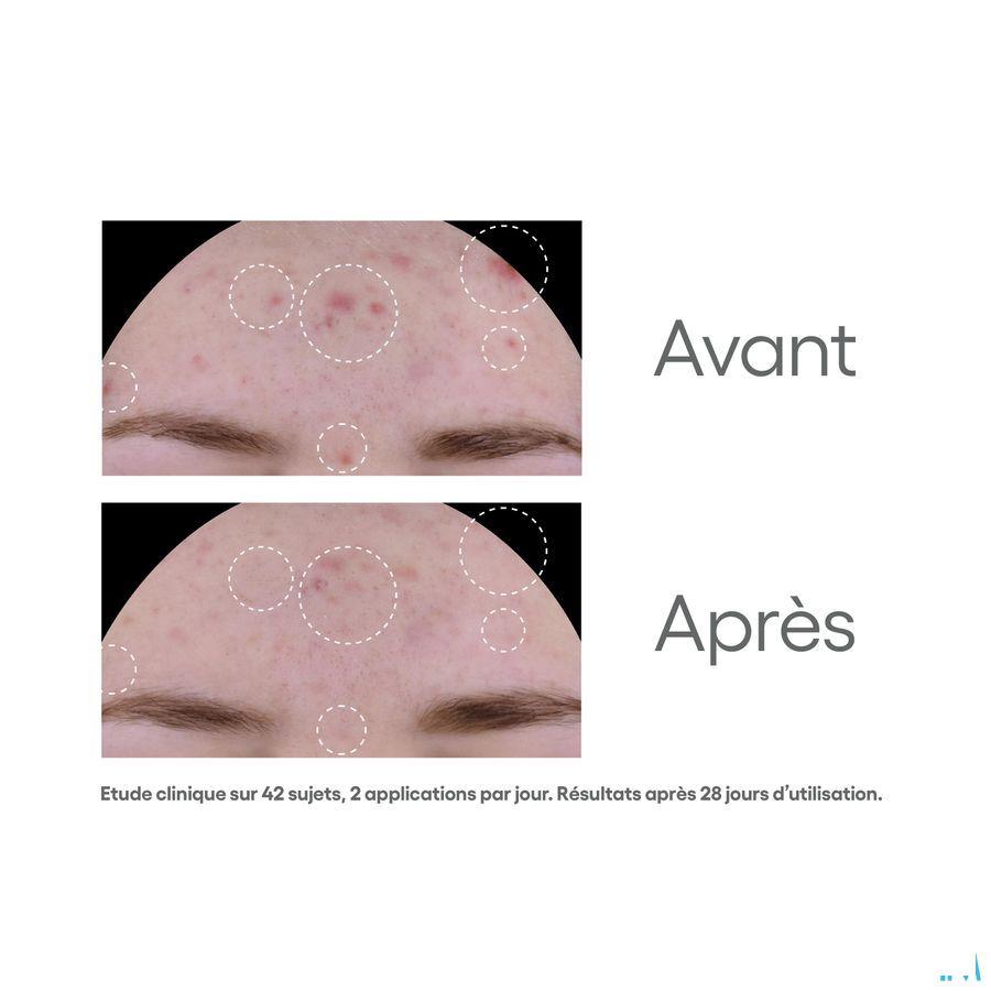 Aderma Biology Ac Global Verzorg. Onzuiverh. 40 ml