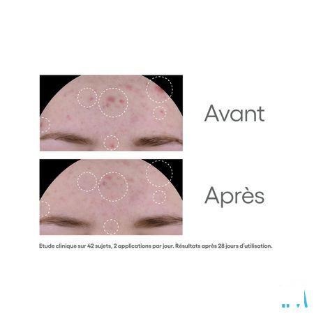 Aderma Biology Ac Global Verzorg. Onzuiverh. 40 ml