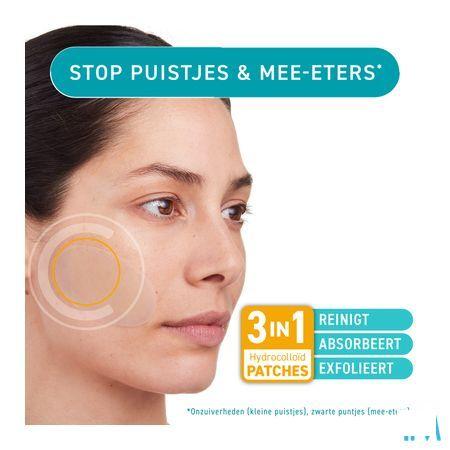 Compeed A/Imperfections Zuiverend Patchs 7