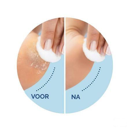 Scholl Velvet Smooth Voetvijl El.+exfol. Dh Blauw