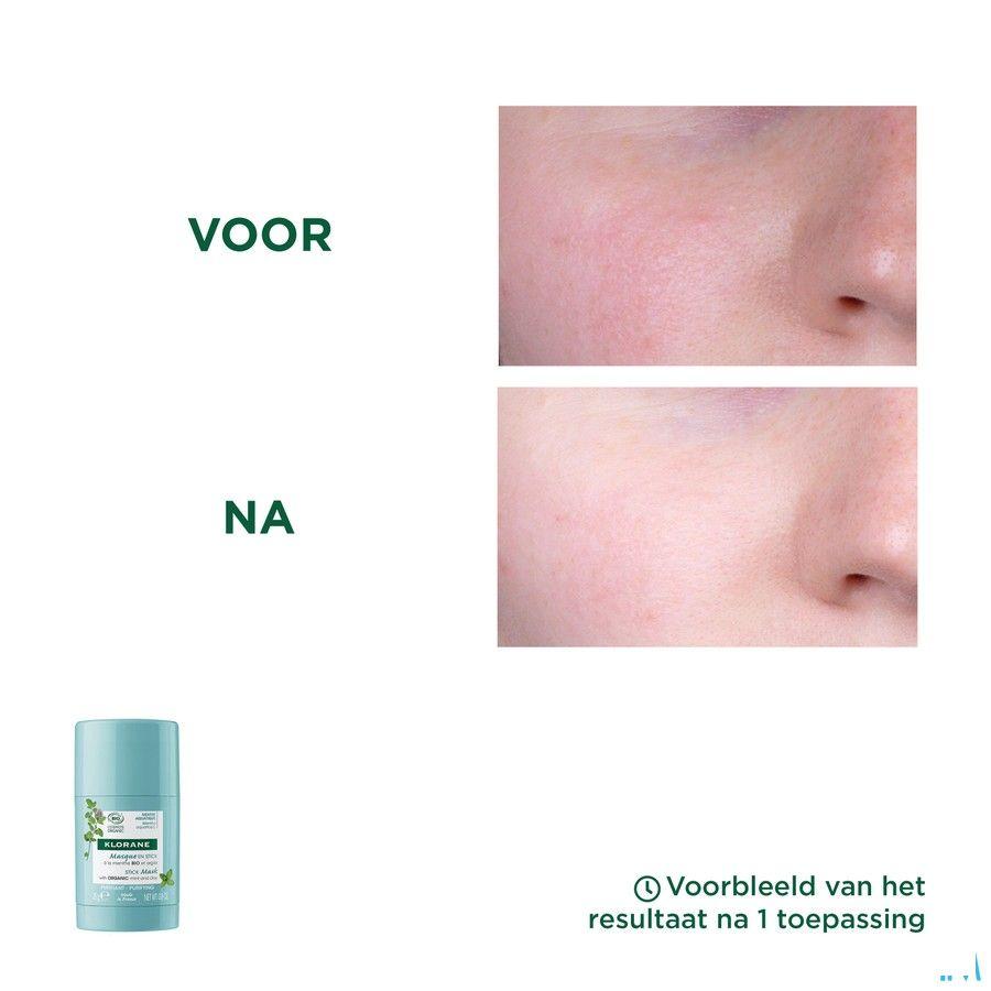 Klorane Visage Menthe Aquatique Masque Stick 25G