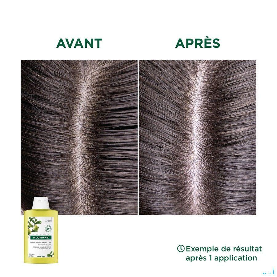 Klorane Capilaire Shampooing Pulpe Cedrat 400 ml