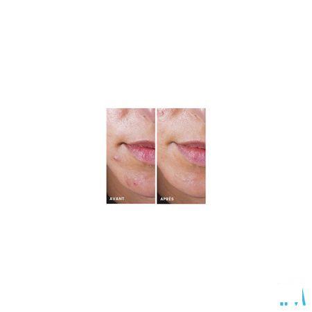 Avene Cleanance Comedomed Repack 30 ml