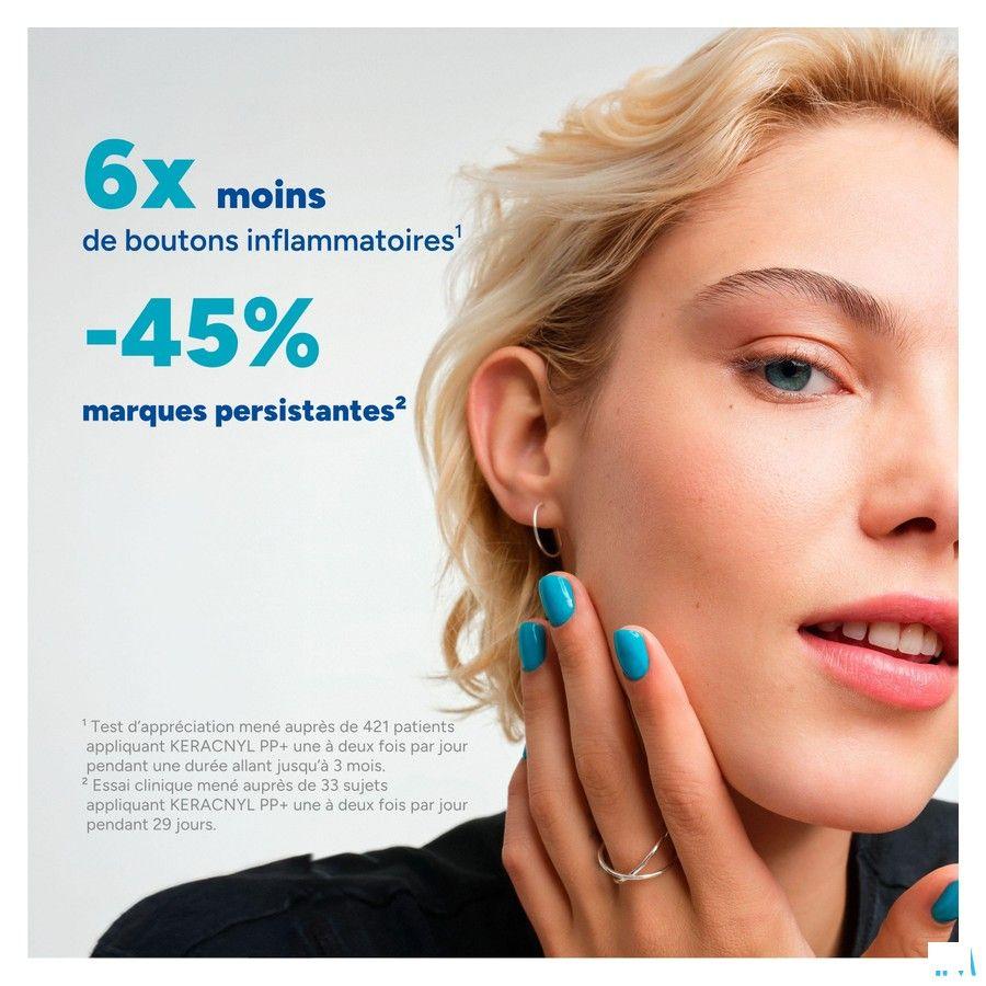 Ducray Keracnyl Pp + Creme 30 ml  -  Ducray Benelux