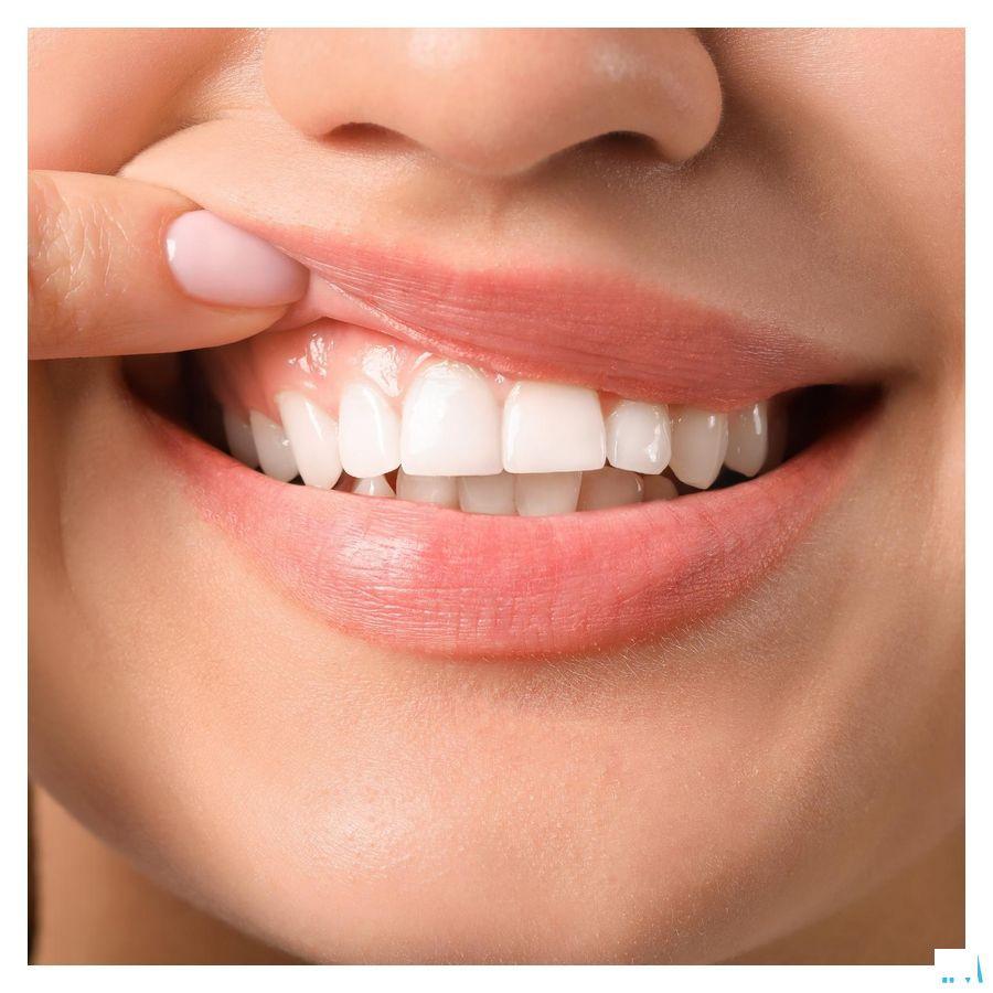 Vitis Gingival Tandenborstel 1 2872  -  Dentaid