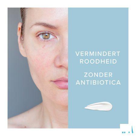 Dermalex Creme Anti rougeurs 30 gr