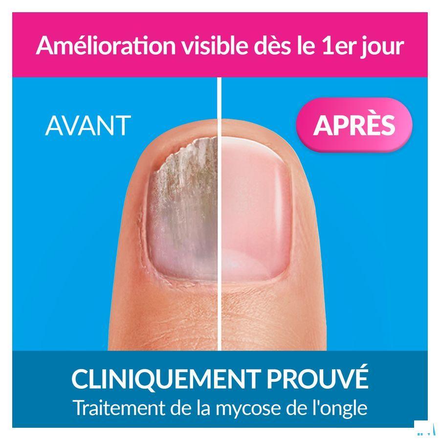 Excilor Forte Schimmelnagels 30 ml