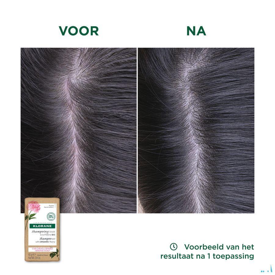 Klorane Capil. Shampooing Solide Pivoine 80 gr