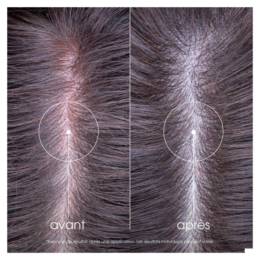 Klorane Capil. Sh Pioenroos Bio 400 ml