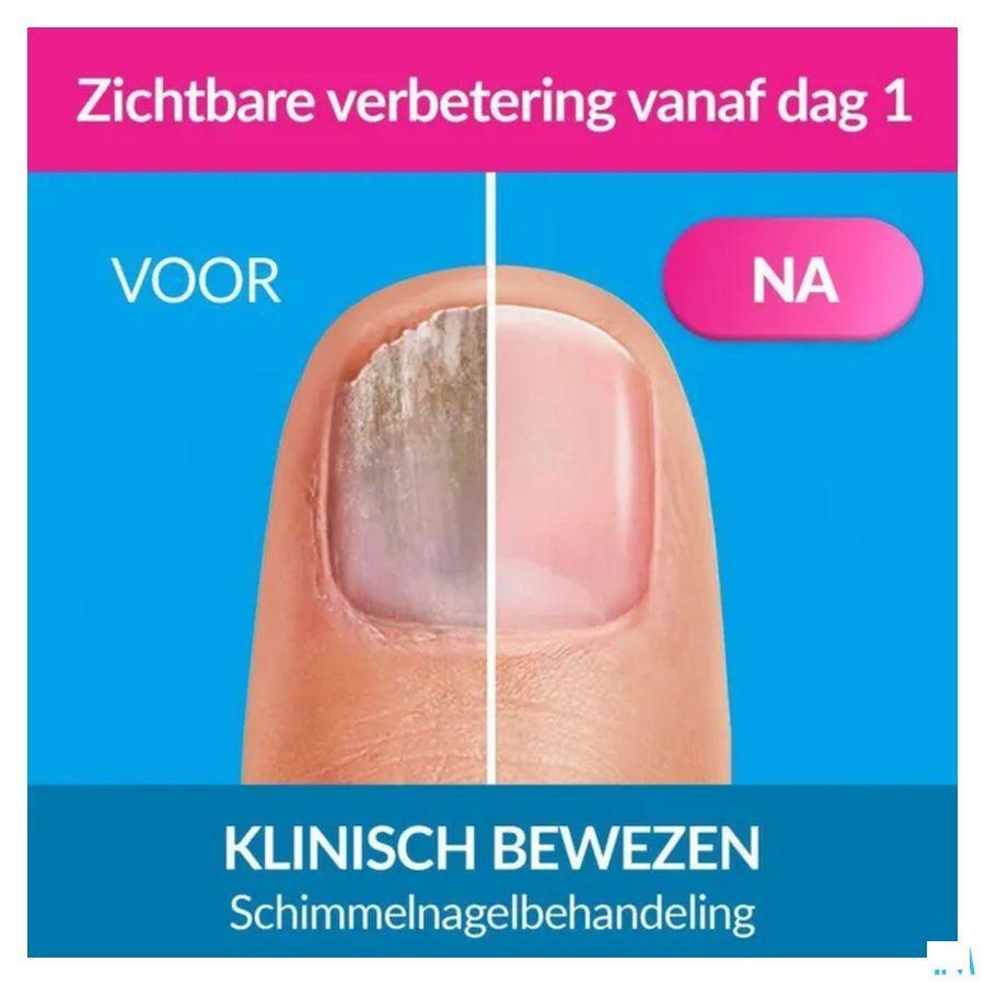 Excilor Forte Schimmelnagels 30 ml