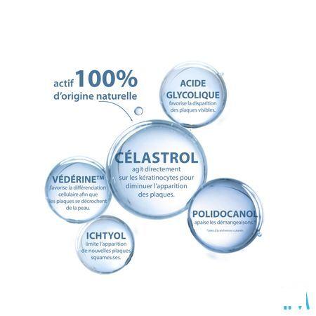 Ducray Kertyol Pso Concentraat 100ml  -  Ducray 