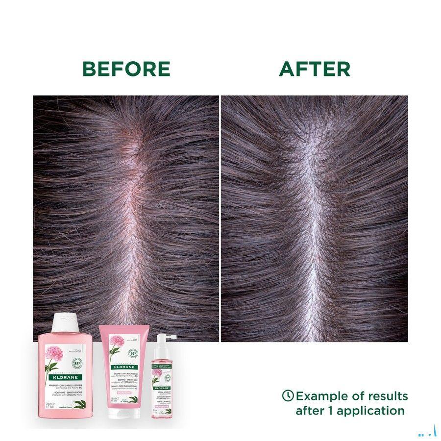 Klorane Capil. Shampoo Pioenroos Bio 100 ml
