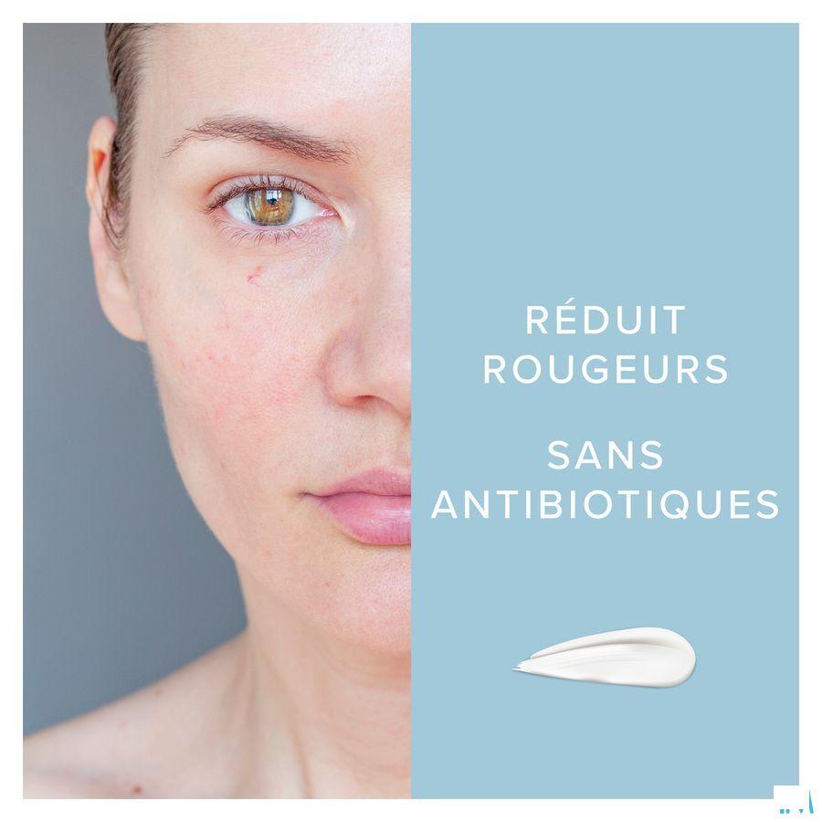 Dermalex Creme Anti rougeurs 30 gr