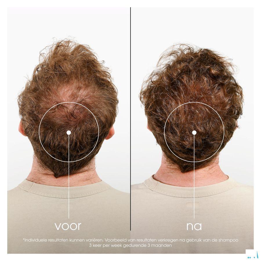 Klorane Capilaire Shampooing Quinine 100 ml