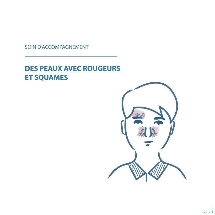 Ducray Kelual Ds Creme 40 ml