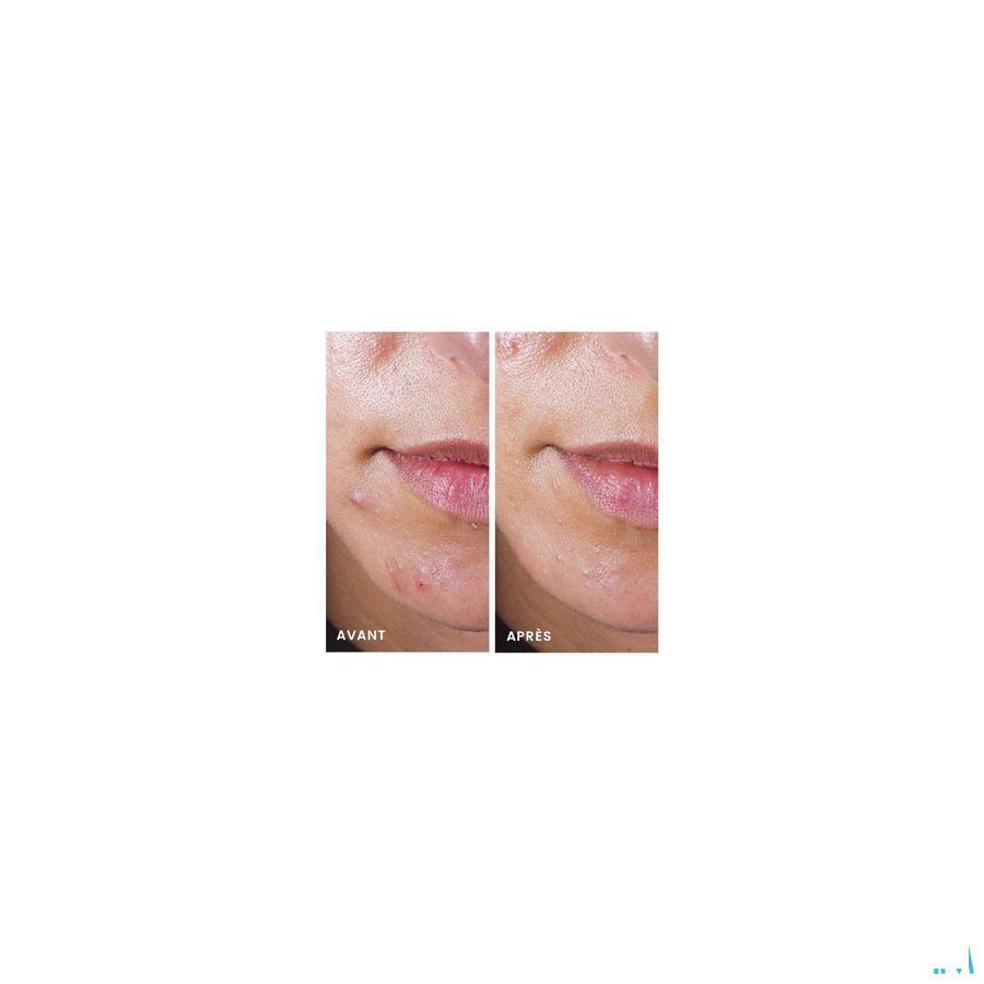 Avene Cleanance Comedomed Repack 30 ml