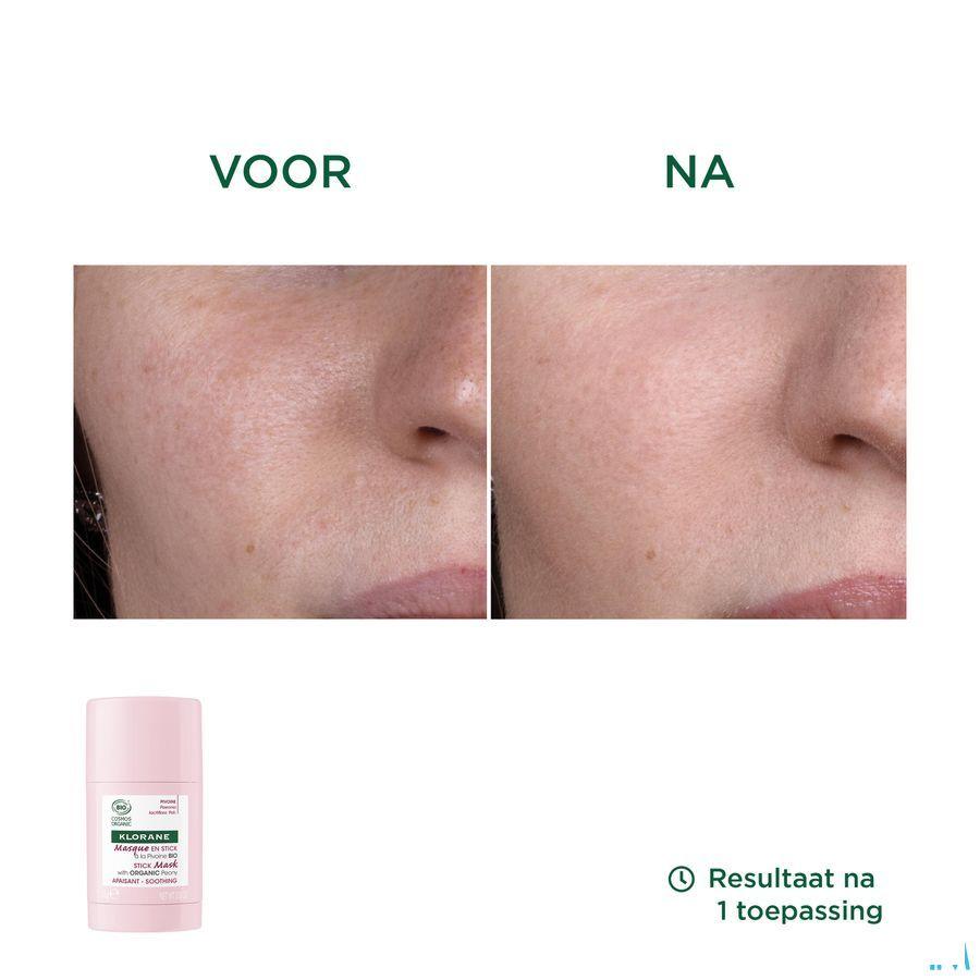 Klorane Gezicht Masker Stick Bio Pioenroos 25 g
