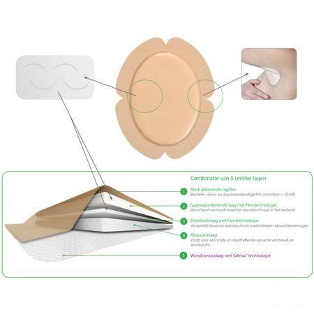 Mepilex Border Flex Verband 7,8x10cm 5 283570  -  Molnlycke Healthcare
