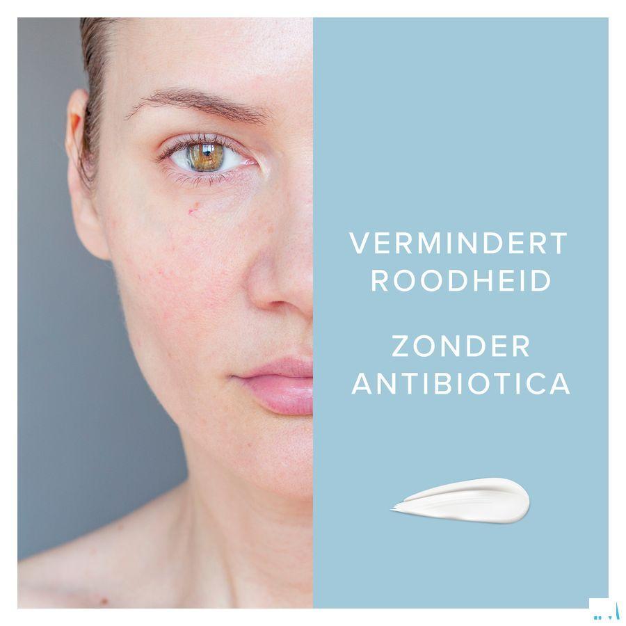 Dermalex Creme Anti rougeurs 30 gr
