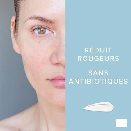Dermalex Creme Anti rougeurs 30 gr