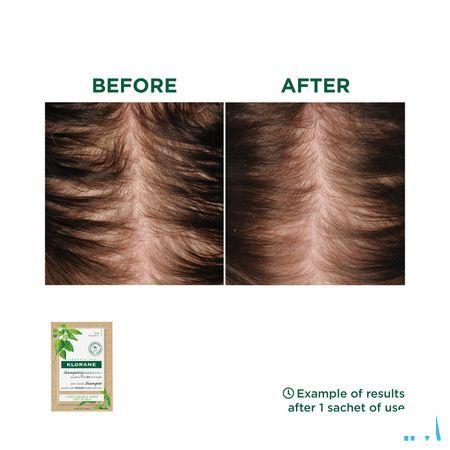 Klorane Capilaire Masker Reinigend Brandnetel 8X3G