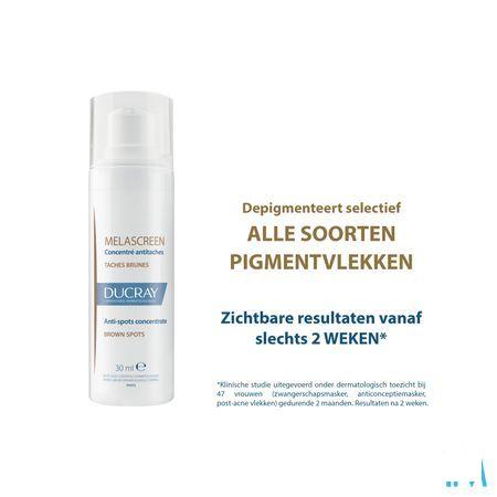 Ducray Melascreen Concentraat A/Pigmentvlek 30 ml
