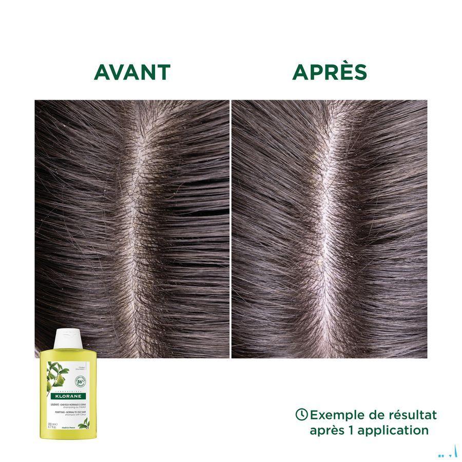 Klorane Capilaire Shampoo Cederappel 200 ml