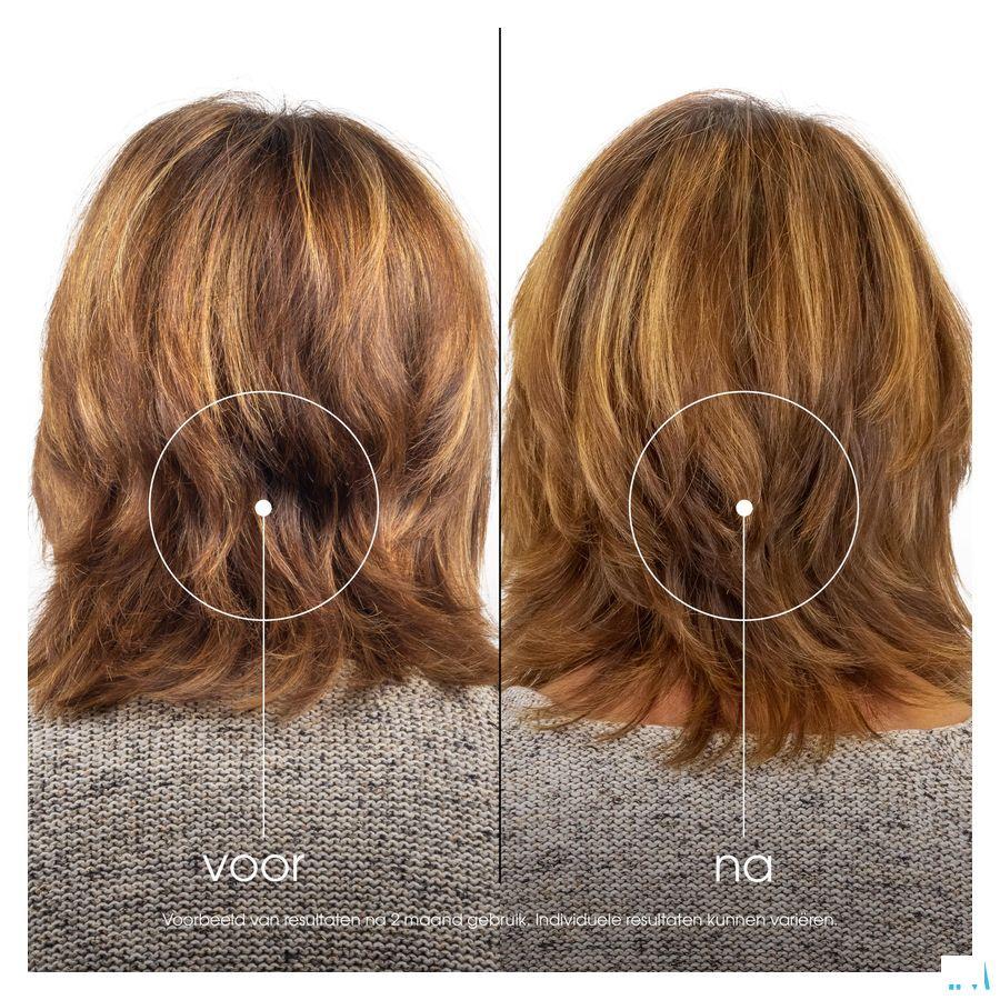 Klorane Capillaire Shampoo Grenade 400 ml Klorane Capillaire Shampoo Grenade 400 ml