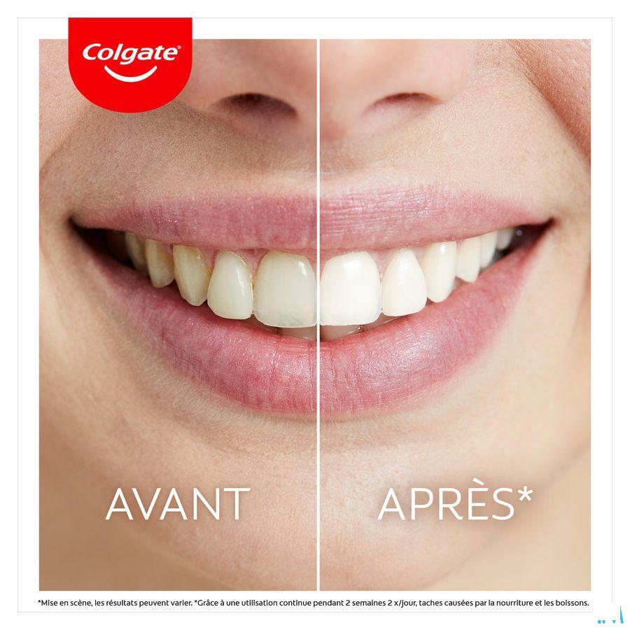 Colgate Max White Led Whitening Kit 2 Prod.