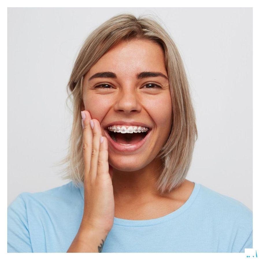 Vitis Orthodontic Access Tandenborstel 2880  -  Dentaid