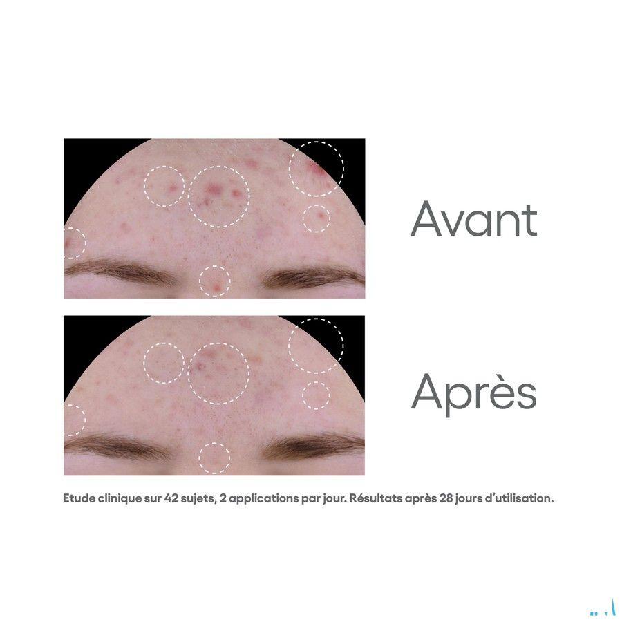 Aderma Biology Ac Global Soin A/Imperfections 40 ml